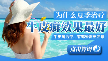 辉县牛皮癣医院