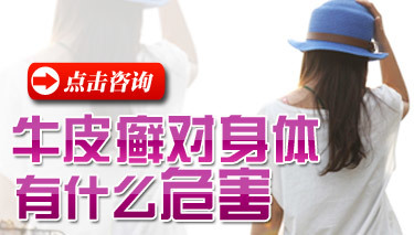 辉县牛皮癣医院