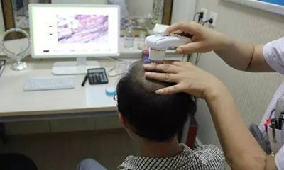辉县脱发专科医院