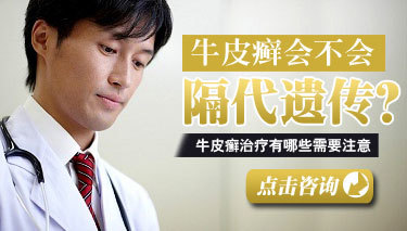 得了牛皮癣皮肤瘙痒怎么办?